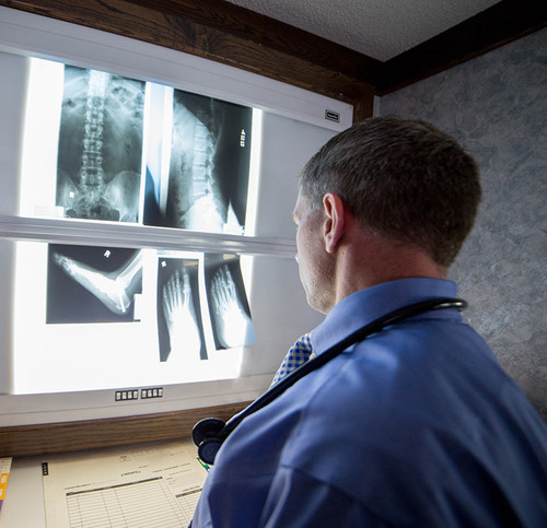 Doctor viewing xray screen